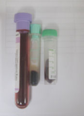 a group of test tubes with blood