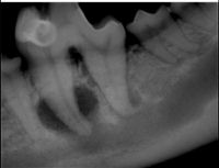 Pet teeth X-Ray